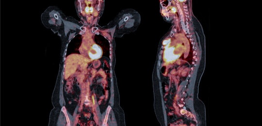 © Mr Suphachai Praserdumrongchai