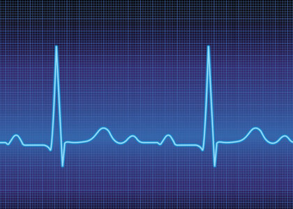 Image of heart beats on a ECG