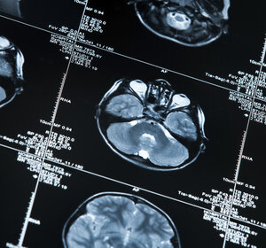 Image showing a MRI scan of a human head