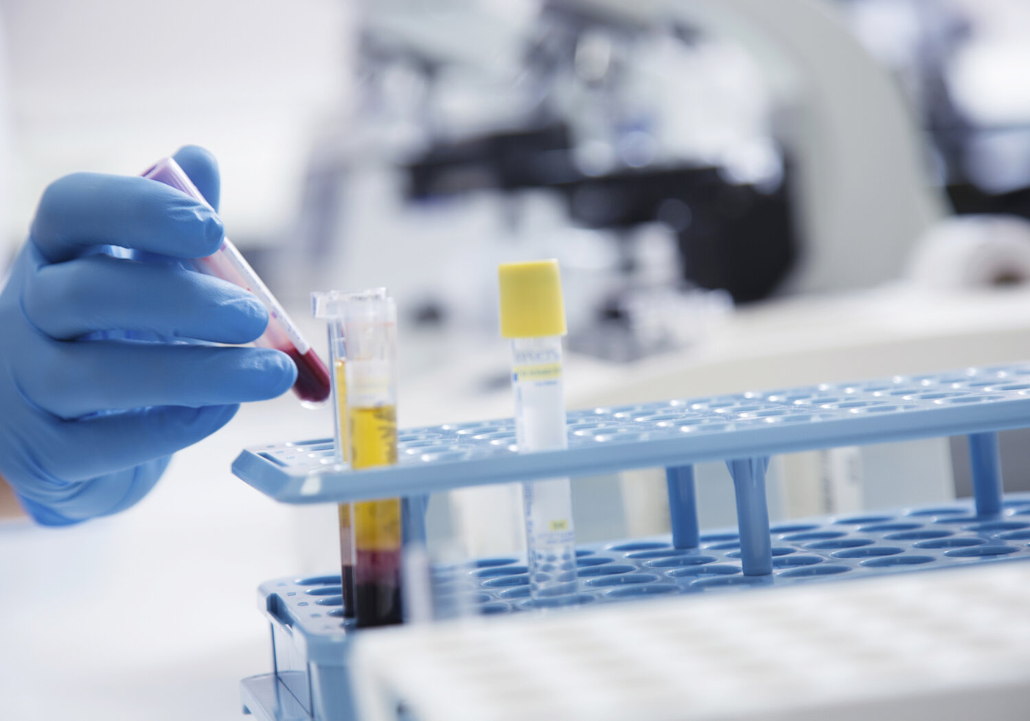Image showing Blood samples being analysed in a hospital